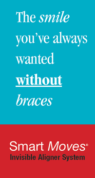 smart moves clear aligners system